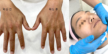 올댓뷰티아카데미 맨즈왁싱과정 수업공개!